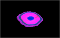 eye?