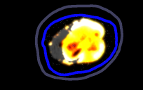 ai generated bhol bomb