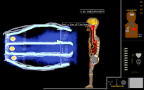 BODY V5 by loadstar VS Jet by dinsor