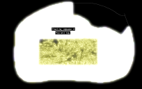 un-neutralized ETRD.